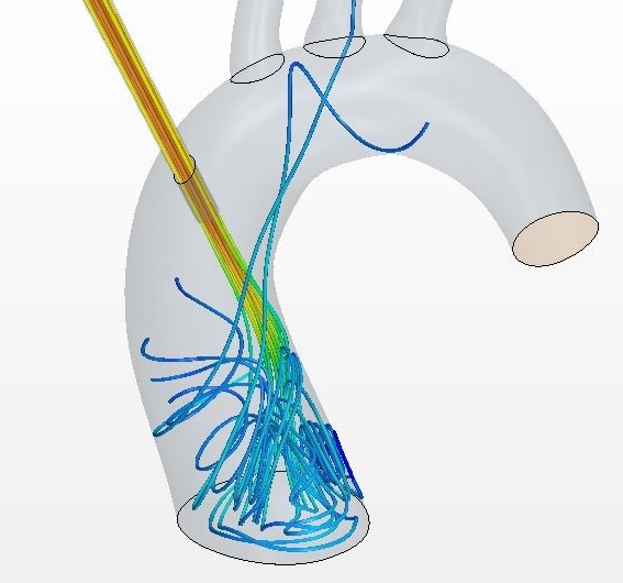 Aorotic root zoom