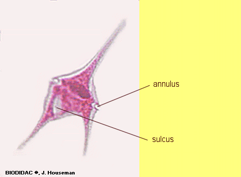 ceratium1e1.GIF (24605 bytes)